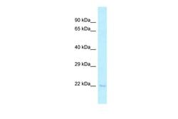 Invitrogen TSEN15 Polyclonal Antibody 100 &mu;L; Unconjugated:Antibodies,