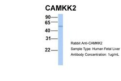 CaMKK beta Polyclonal Antibody:Antibodies, Polyclonal