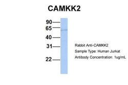 CaMKK beta Polyclonal Antibody:Antibodies, Polyclonal
