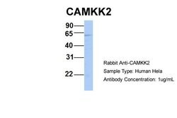 CaMKK beta Polyclonal Antibody:Antibodies, Polyclonal
