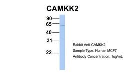 CaMKK beta Polyclonal Antibody:Antibodies, Polyclonal