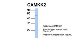 CaMKK beta Polyclonal Antibody:Antibodies, Polyclonal