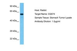 Invitrogen C17orf74 Polyclonal Antibody 100 &mu;L; Unconjugated:Antibodies,