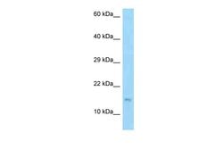 Invitrogen EDDM3B Polyclonal Antibody 100 &mu;L; Unconjugated:Antibodies,