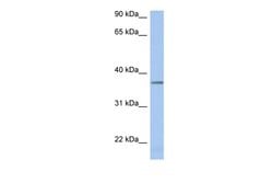 Invitrogen LDHAL6B Polyclonal Antibody 100 &mu;L; Unconjugated:Antibodies,