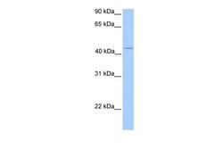 Invitrogen C17orf97 Polyclonal Antibody 100 &mu;L; Unconjugated:Antibodies,