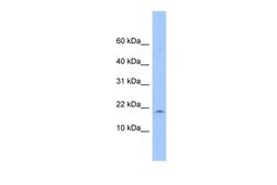 LOC285033 Polyclonal Antibody 100 &mu;L | Buy Online | Invitrogen | Fisher Scientific