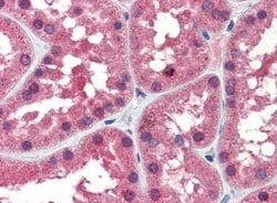 Invitrogen IDH1 Polyclonal Antibody 100 &mu;L | Buy Online | Invitrogen&trade; | Fisher Scientific