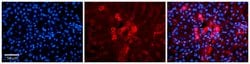 Invitrogen METL5 Polyclonal Antibody 100 &mu;L; Unconjugated:Antibodies,
