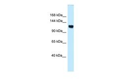 Invitrogen&trade;&nbsp;ANKS1 Polyclonal Antibody