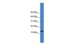 Invitrogen C14orf48 Polyclonal Antibody 100 &mu;L | Buy Online | Invitrogen&trade; | Fisher Scientific