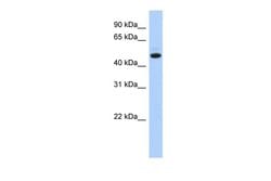Invitrogen KIAA0825 Polyclonal Antibody 100 &mu;L; Unconjugated:Antibodies,