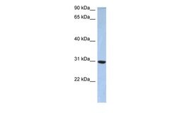 Invitrogen C16orf65 Polyclonal Antibody 100 &mu;L; Unconjugated:Antibodies,