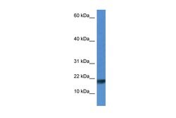 ISCU Polyclonal Antibody, Invitrogen&trade;