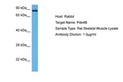 Invitrogen PDE4B Polyclonal Antibody 100 &mu;L; Unconjugated:Antibodies,