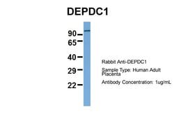Invitrogen DEPDC1 Polyclonal Antibody 100 &mu;L; Unconjugated:Antibodies,