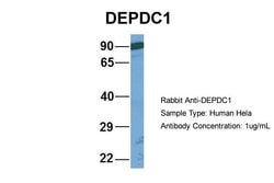 Invitrogen DEPDC1 Polyclonal Antibody 100 &mu;L; Unconjugated:Antibodies,