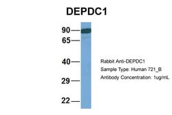 Invitrogen DEPDC1 Polyclonal Antibody 100 &mu;L; Unconjugated:Antibodies,