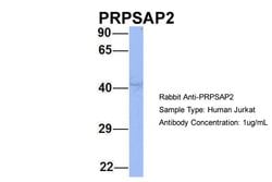 Invitrogen PRPSAP2 Polyclonal Antibody 100 &mu;L; Unconjugated:Antibodies,