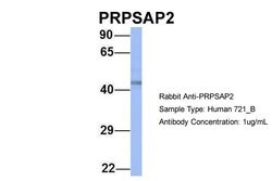 Invitrogen PRPSAP2 Polyclonal Antibody 100 &mu;L; Unconjugated:Antibodies,