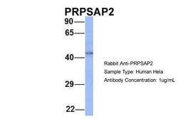 Invitrogen PRPSAP2 Polyclonal Antibody 100 &mu;L; Unconjugated:Antibodies,
