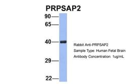 Invitrogen PRPSAP2 Polyclonal Antibody 100 &mu;L; Unconjugated:Antibodies,