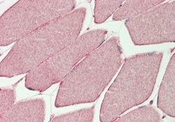 Invitrogen PHKG1 Polyclonal Antibody 100 &mu;L; Unconjugated:Antibodies,