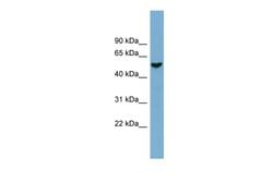 Invitrogen FAM83E Polyclonal Antibody 100 &mu;L; Unconjugated:Antibodies,