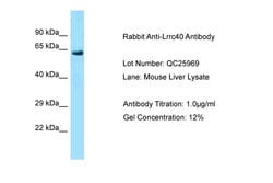 Invitrogen LRRC40 Polyclonal Antibody 100 &mu;L; Unconjugated:Antibodies,