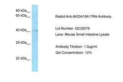 Invitrogen HMCES Polyclonal Antibody 100 &mu;L; Unconjugated:Antibodies,