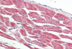 Invitrogen PKA alpha Polyclonal Antibody 100 &mu;L; Unconjugated:Antibodies,