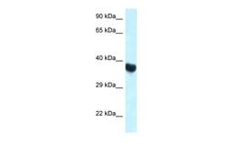 Invitrogen HOXA11 Polyclonal Antibody 100 &mu;L; Unconjugated:Antibodies,
