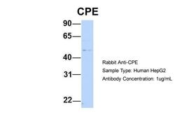 Invitrogen Carboxypeptidase E Polyclonal Antibody 100 &mu;L; Unconjugated:Antibodies,