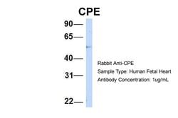 Invitrogen Carboxypeptidase E Polyclonal Antibody 100 &mu;L; Unconjugated:Antibodies,