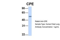 Invitrogen Carboxypeptidase E Polyclonal Antibody 100 &mu;L; Unconjugated:Antibodies,