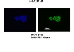 Invitrogen hnRNP H1 Polyclonal Antibody 100 &mu;L; Unconjugated:Antibodies,
