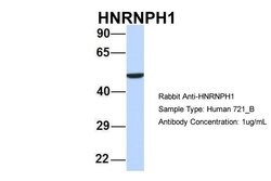 Invitrogen hnRNP H1 Polyclonal Antibody 100 &mu;L; Unconjugated:Antibodies,