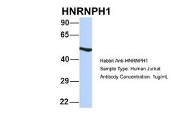 Invitrogen hnRNP H1 Polyclonal Antibody 100 &mu;L; Unconjugated:Antibodies,