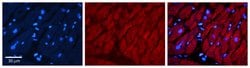 Invitrogen TIMP3 Polyclonal Antibody 100 &mu;L; Unconjugated:Antibodies,
