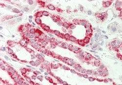 Invitrogen MGST3 Polyclonal Antibody 100 &mu;L; Unconjugated:Antibodies,