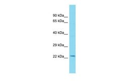 Invitrogen FYTTD1 Polyclonal Antibody 100 &mu;L; Unconjugated:Antibodies,