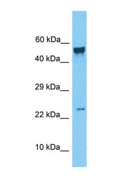 Invitrogen NAA38 Polyclonal Antibody 100 &mu;L; Unconjugated:Antibodies,