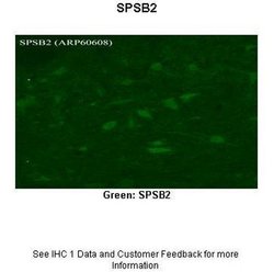 Invitrogen SPSB2 Polyclonal Antibody 100 &mu;L | Buy Online | Invitrogen&trade; | Fisher Scientific