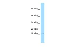 Invitrogen CKS1 Polyclonal Antibody 100 &mu;L; Unconjugated:Antibodies,