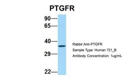 Invitrogen PTGFR Polyclonal Antibody 100 &mu;L; Unconjugated:Antibodies,