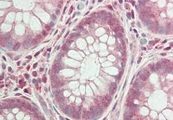 Invitrogen GLTSCR1 Polyclonal Antibody 100 &mu;L; Unconjugated:Antibodies,