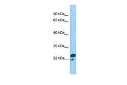 Invitrogen SPIN2A Polyclonal Antibody 100 &mu;L; Unconjugated:Antibodies,