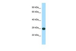 Invitrogen LRRC10 Polyclonal Antibody 100 &mu;L; Unconjugated:Antibodies,