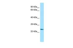 Invitrogen DPRX Polyclonal Antibody 100 &mu;L; Unconjugated:Antibodies,