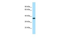 Invitrogen ASB14 Polyclonal Antibody 100 &mu;L; Unconjugated:Antibodies,